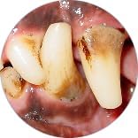 Gel with Wild Salmon Oil. As Seen On TV Pet Dental, Don't Mess with Harsh Chemicals in Your pet's Food or Water, Simply Swipe on Teeth and Your pet's Teeth and Gums Will Improve.-PurrikoPets